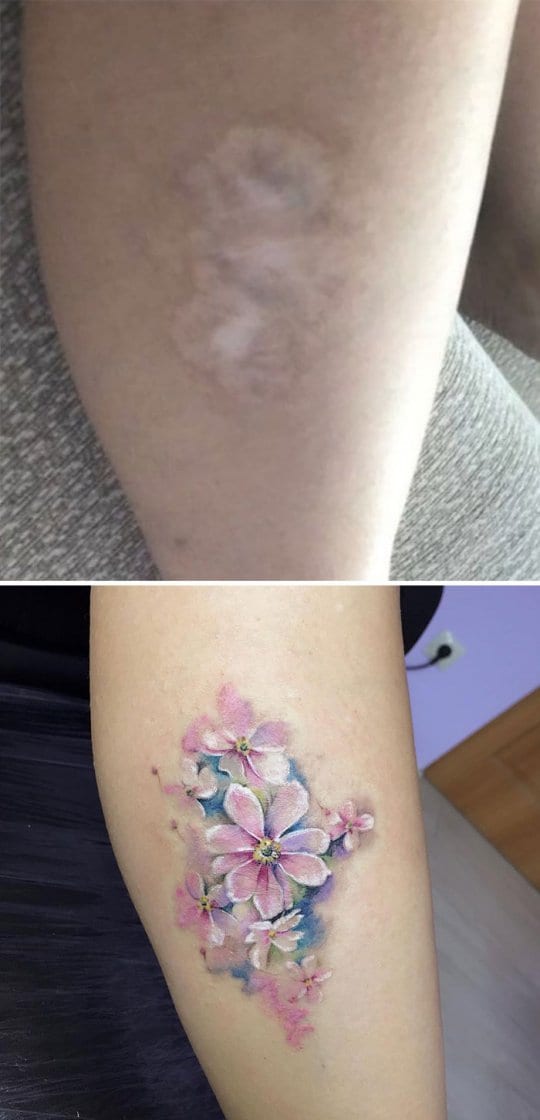 These pink flowers are so pretty. You can’t even tell there is a scar underneath all that. The pastel colours make this tattoo look like a work of art.