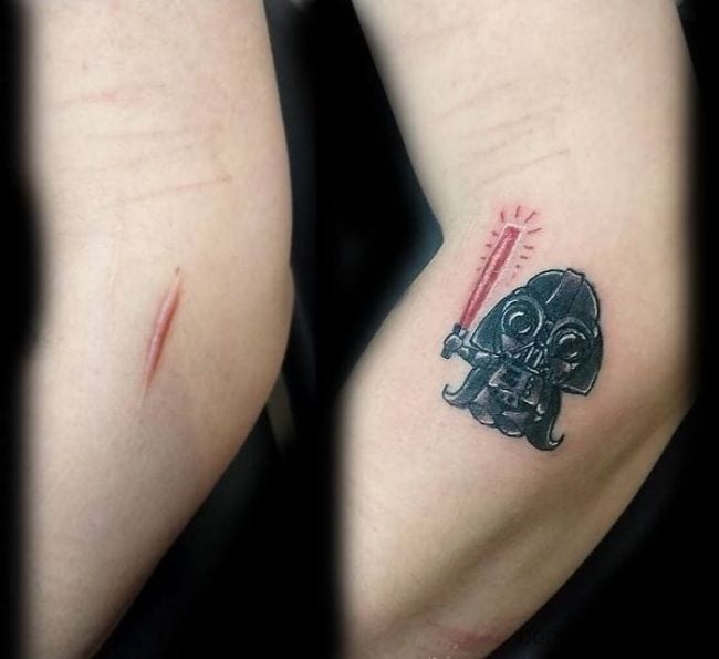This person turned this scar into an iconic character. This is either Darth Vader or Dart Stewie. I guess it could be either one. I do love how the tattoo artist incorporated the red scar as the light saber in the design.