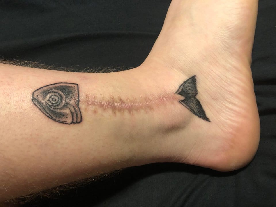 Here is another fish tattoo that incorporates the scar as a part of the design. The stitch pattern even looks like fish bones. While not as active as the previous marlin tattoo, I think this tattoo does its job just as well.