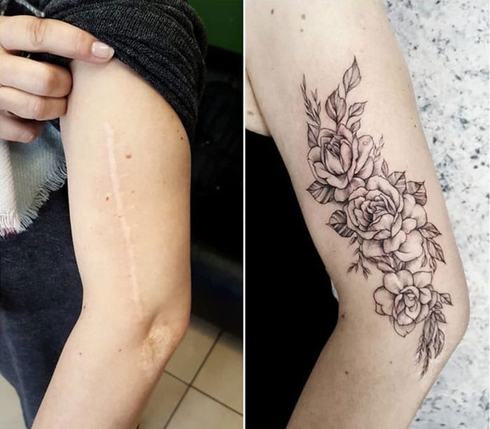 This small patch of flowers does a lot to cover up this scar on this person’s arm. You can’t even see that a scar is there, meaning the tattoo has accomplished its mission. The artist doesn’t even have to add any color, as this tattoo looks perfect without it.